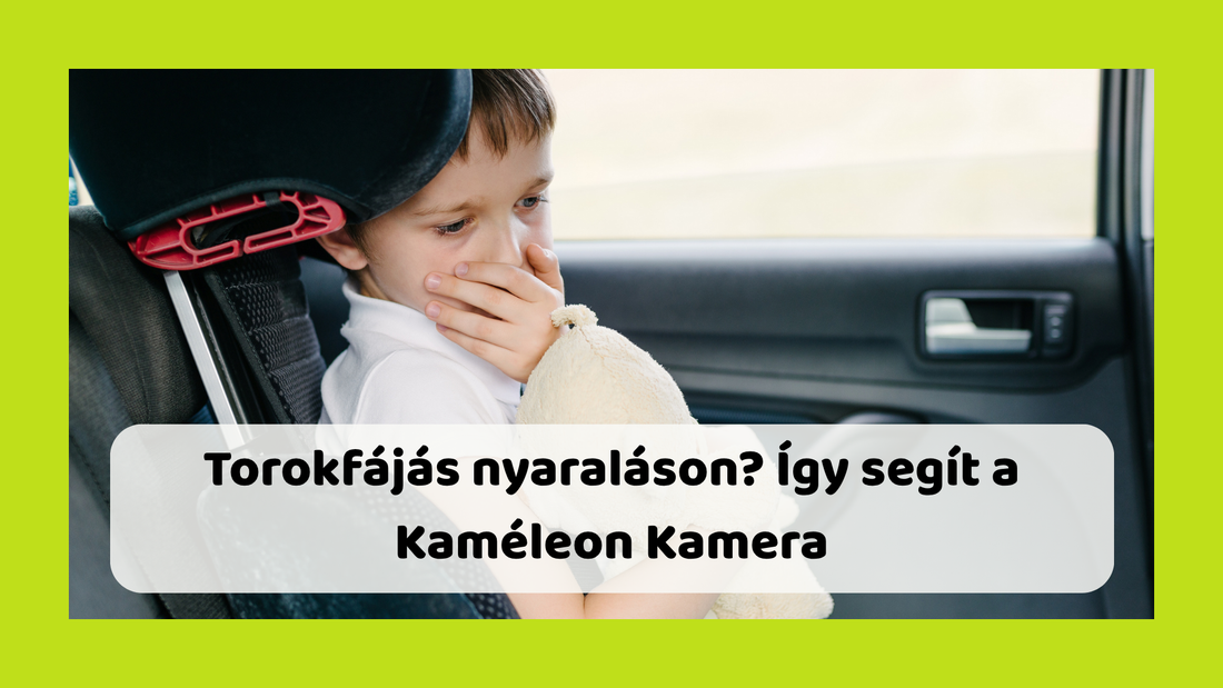 Torokfájás nyaraláson? Így segít a Kaméleon Kamera