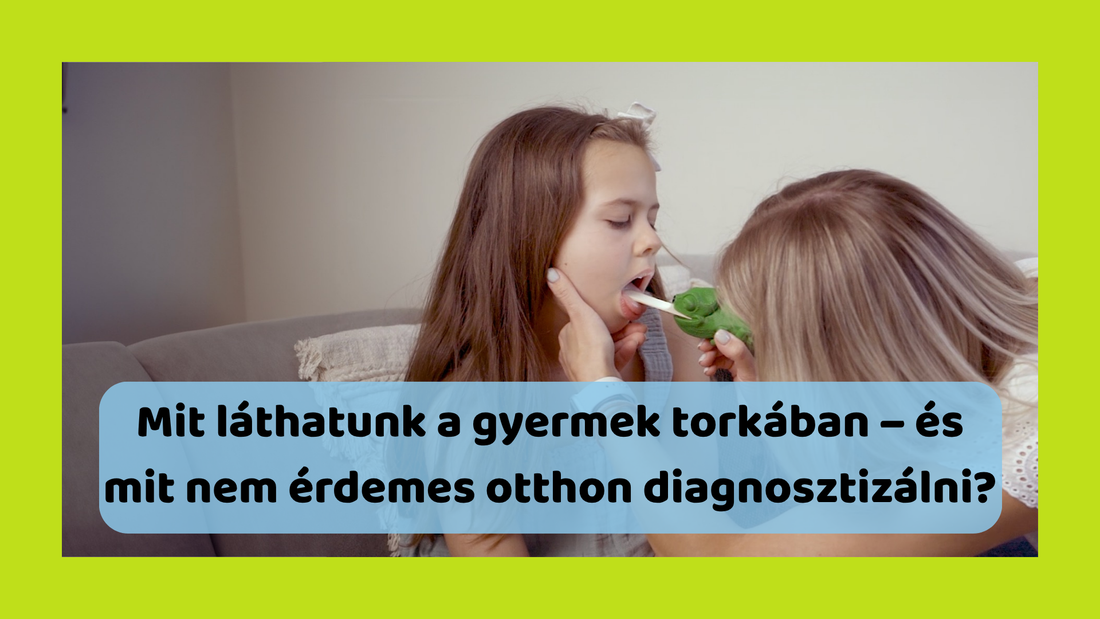 Mit láthatunk a gyermek torkában – és mit nem érdemes otthon diagnosztizálni?